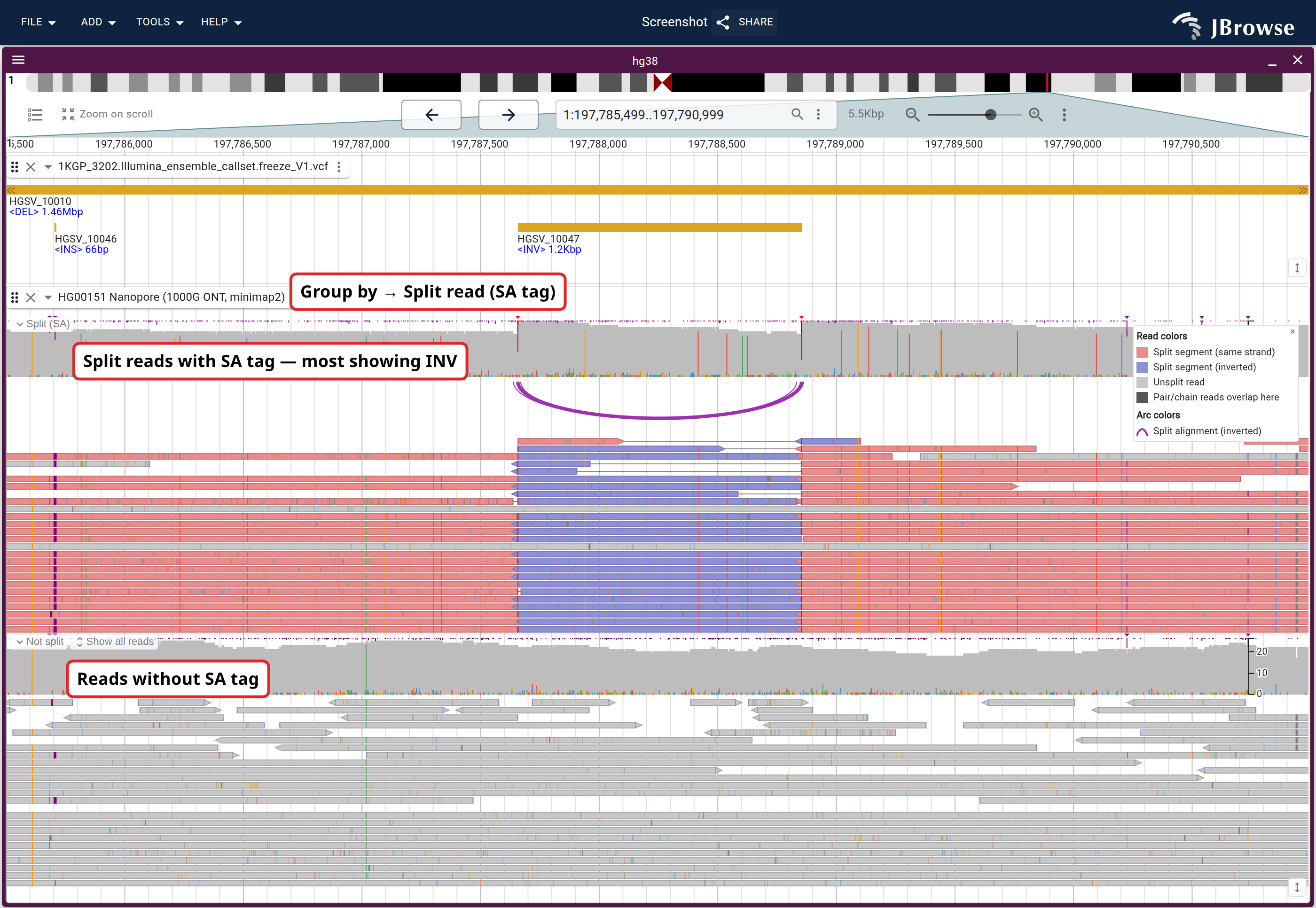 Reads grouped by Group by... → Split read (SA tag) over HGSV_10047 in HG00151 nanopore reads, with the 1KGP ensemble VCF call above. The split reads in the upper section break into three pieces with the middle one reversed; the reads below cross the same span in one piece.