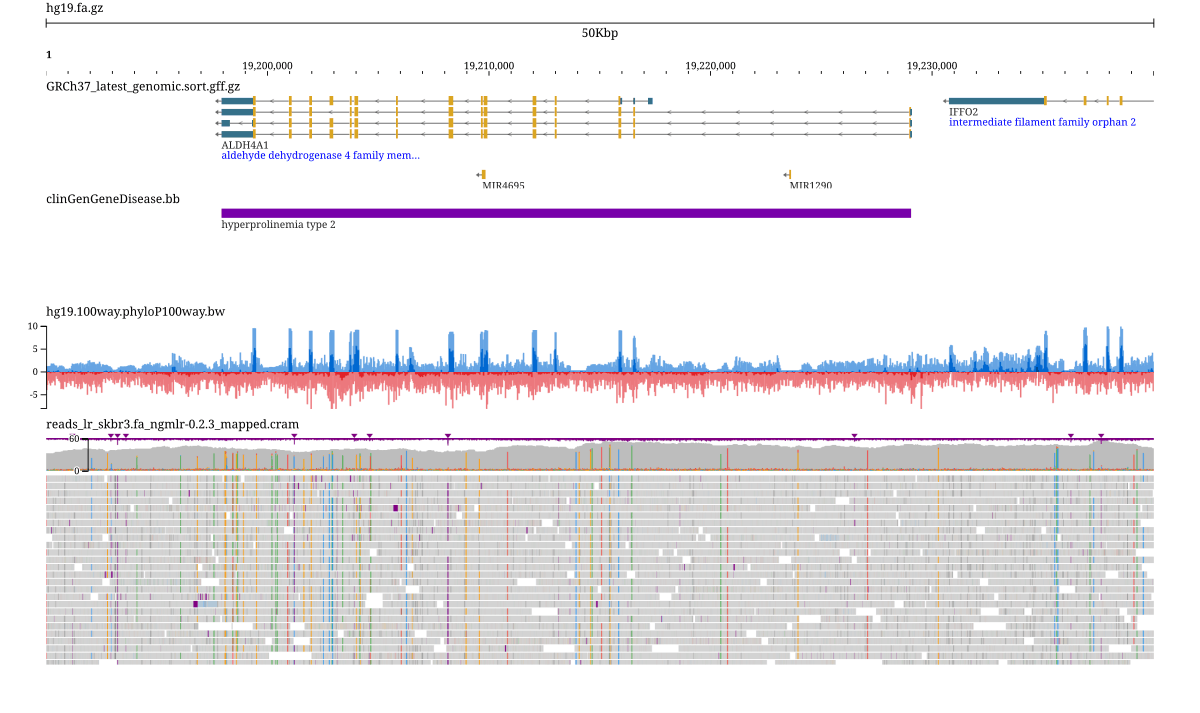 A multi-track hg19 view: NCBI RefSeq genes, ClinGen gene-disease mapping, phyloP conservation, and SKBR3 nanopore reads