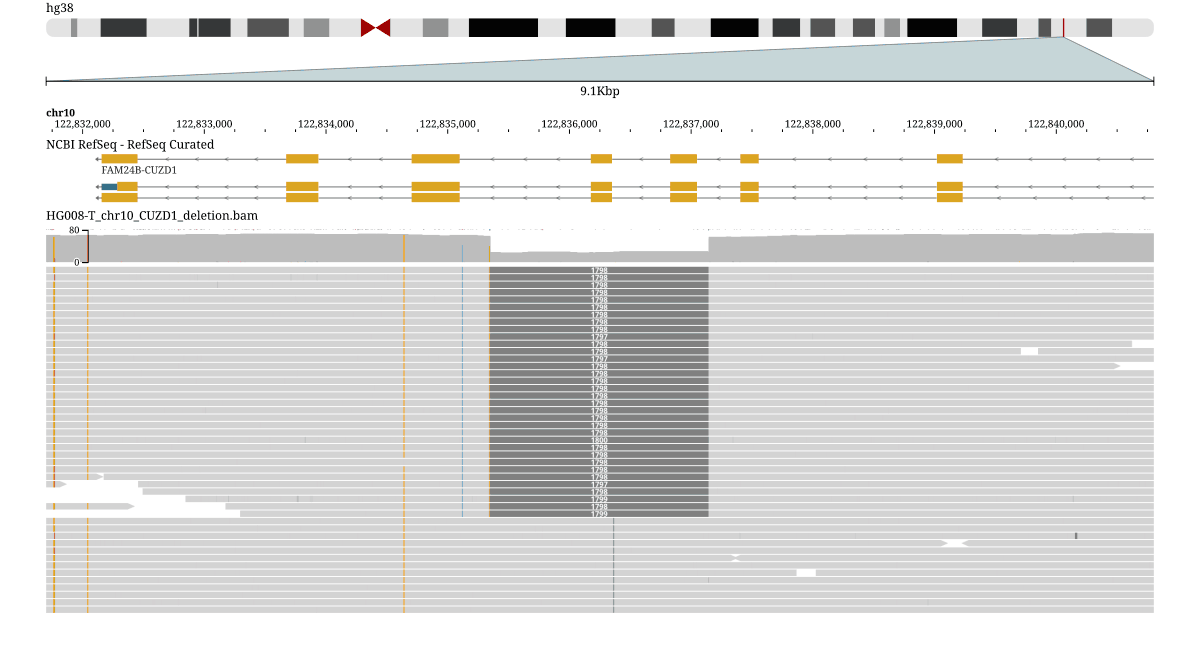 HG008-T PacBio HiFi reads over CUZD1, sorted by the base at the center position so the reads carrying a ~1.8 kb somatic deletion cluster into one band