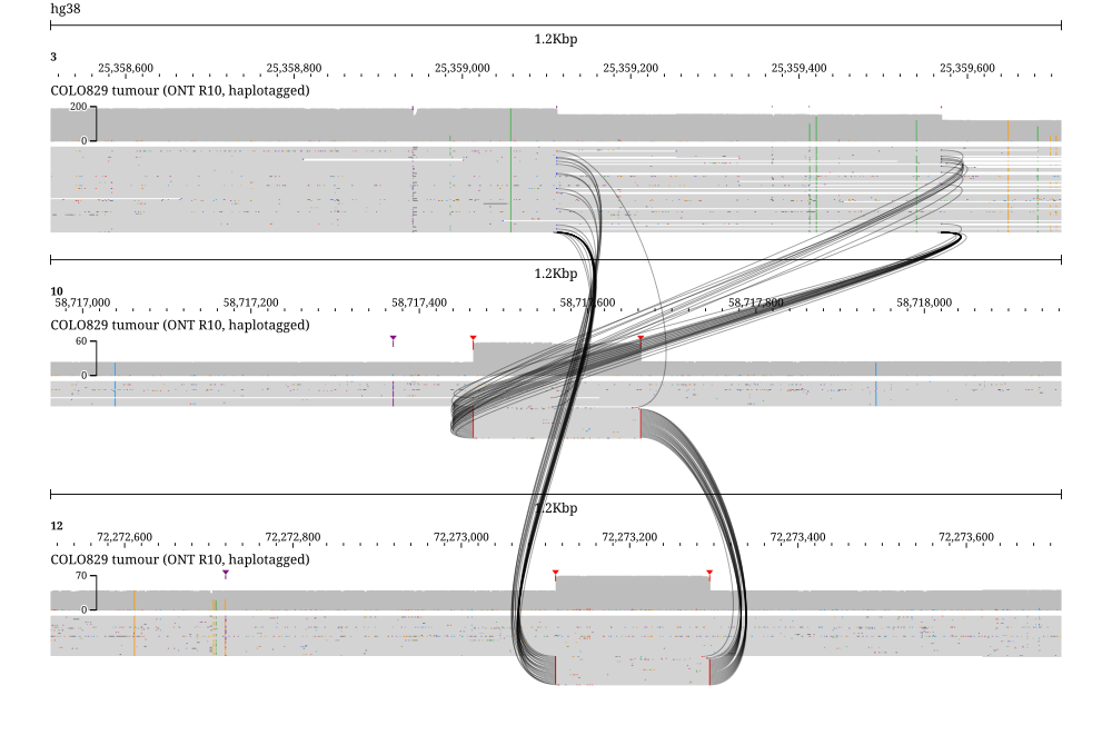 The three loci of the COLO829 melanoma line's der(3), chr3 then chr10 then chr12, in the tumour nanopore reads. Every connecting curve is solid