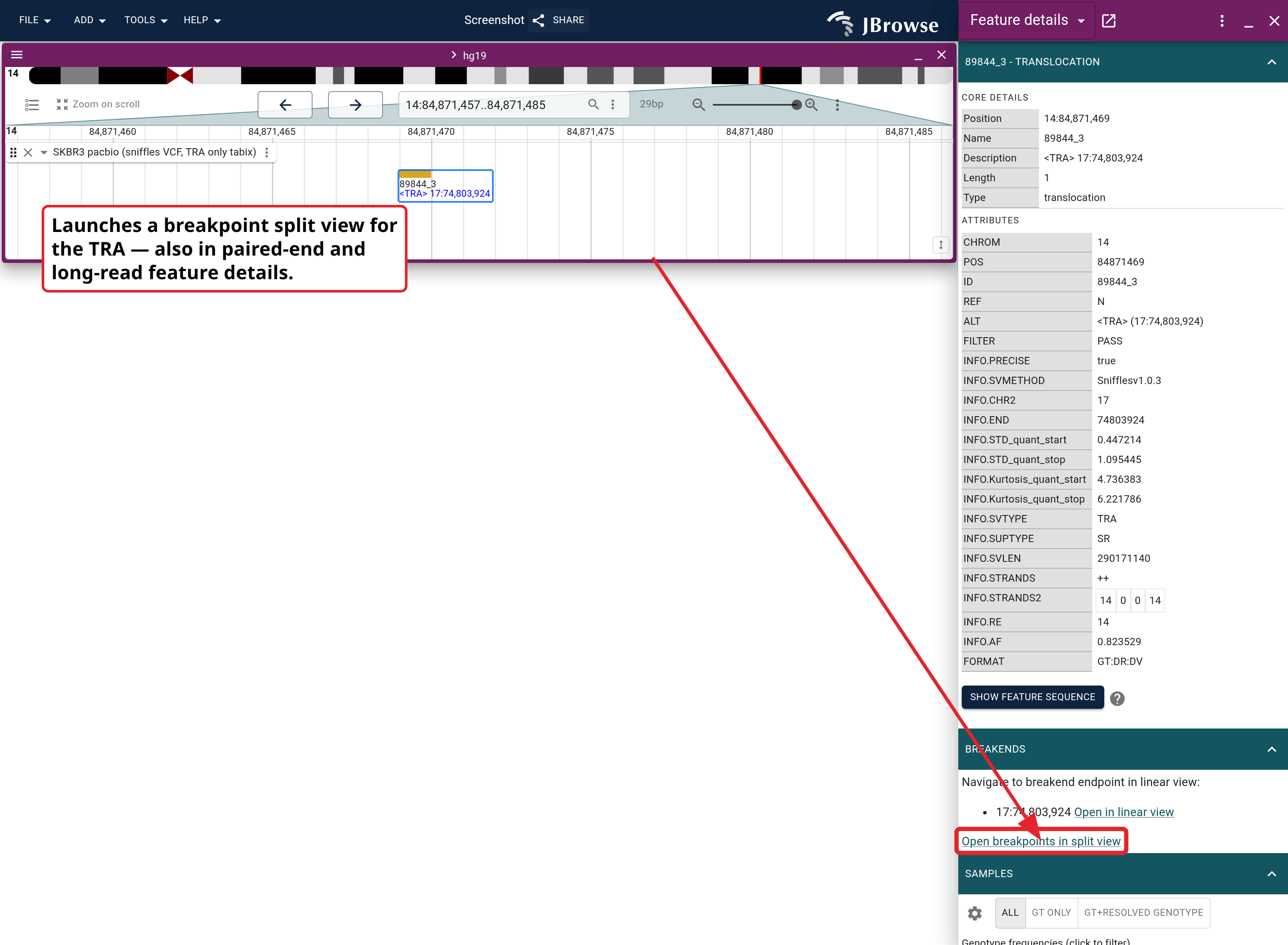 Feature details panel for a TRA variant. The Breakends section lists each endpoint with its own 'Open in linear view' link, and below them a single 'Open breakpoints in split view' link that opens both loci at once.