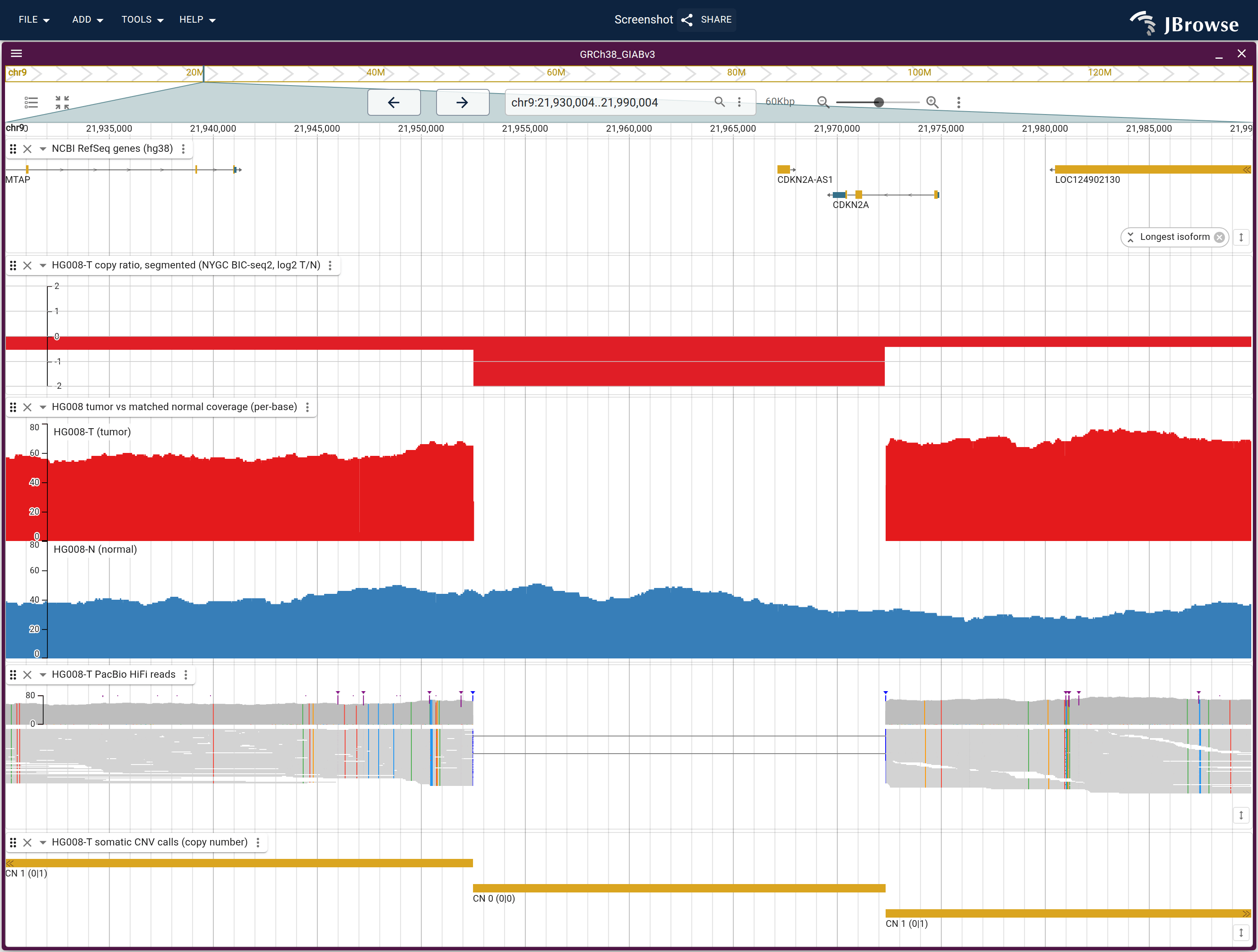 The CDKN2A deletion at 60 kb: coverage drops out in the tumor row and not in the normal, the read pileup drops out with it, and the CNV call under them reads CN 0.