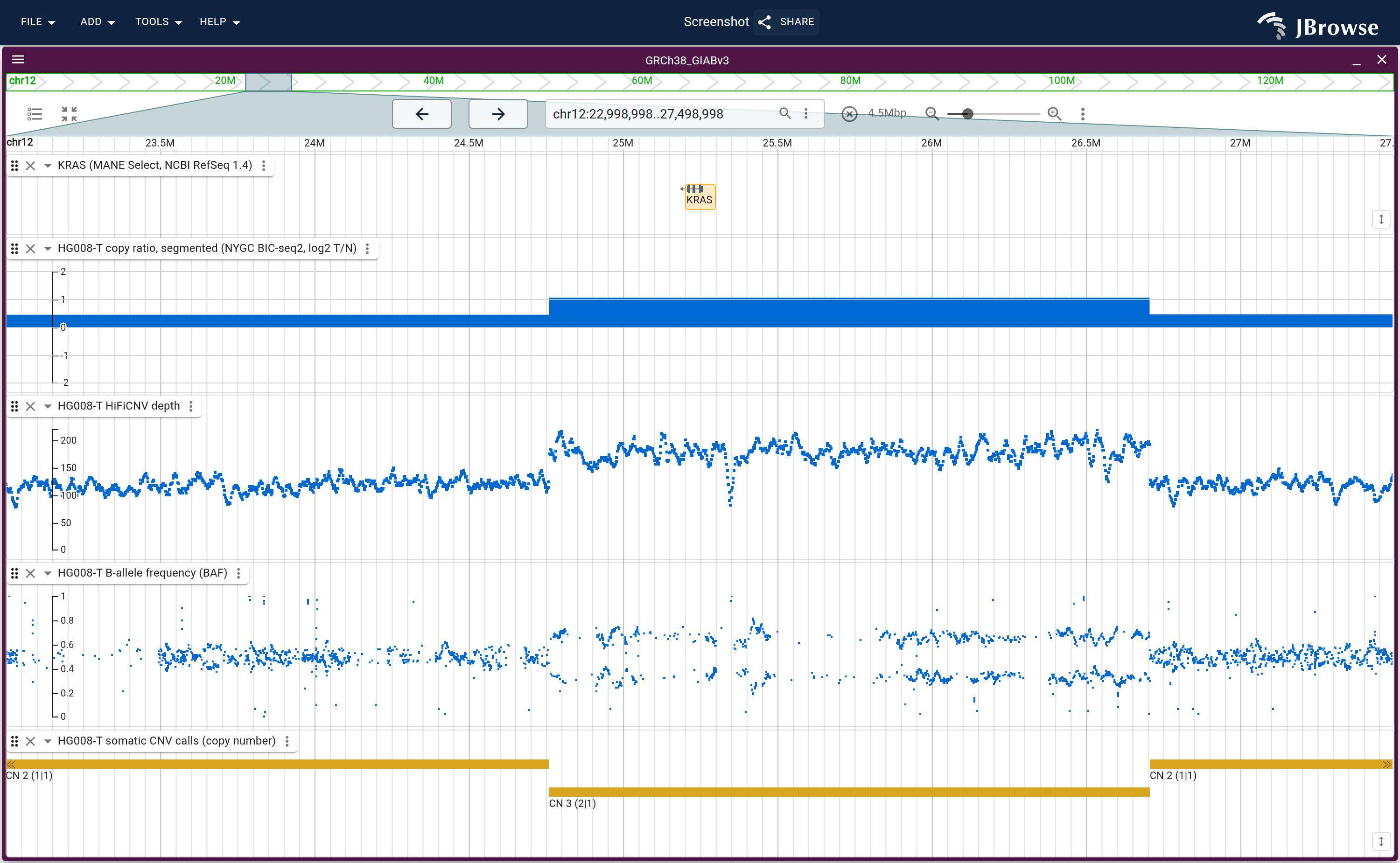 KRAS on chr12: its MANE Select transcript over the segmented copy ratio, the HiFiCNV depth and the BAF, above the CNV calls. Over the tandem duplication the copy-ratio edges land on the called boundaries and the BAF separates into two bands.