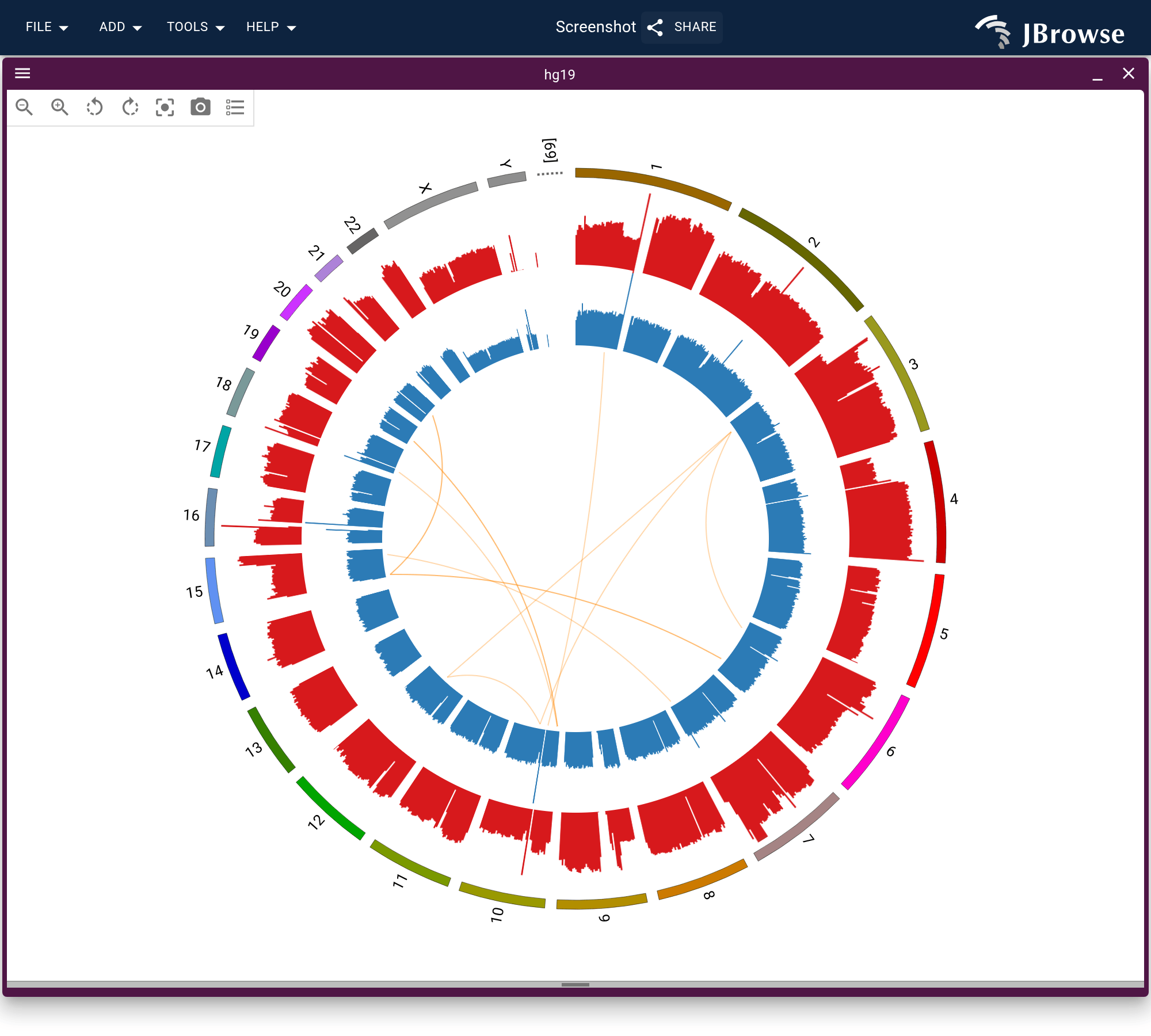 A tumour and its matched normal from one multi-source quantitative track, a band each inside the ring, with the somatic SV truth set as chords. The tumour band steps between levels across whole chromosomes; the normal holds even over the same stretches.